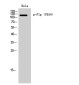Phospho-FGFR1 (Tyr654) Rabbit pAb ABZ4582
