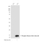Phospho-Histone H2A.X (Ser139) (7G9) Mouse mAb ABZ4585