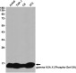Phospho-Histone H2A.X (Ser139) Rabbit mAb ABZ4586