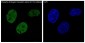 Phospho-ER alpha (Ser118) Rabbit mAb ABZ4594