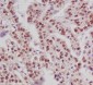 Phospho-ER alpha (Ser118) Rabbit mAb ABZ4594