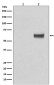 Phospho-ER alpha (Ser118) Rabbit mAb ABZ4594