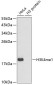 MonoMethyl-Histone H3 (Lys4) Rabbit pAb ABZ4601