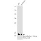 MonoMethyl-Histone H3 (Lys18) Rabbit mAb ABZ4616