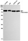 [KD]NAK/TBK1 Rabbit mAb ABZ4632