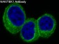 [KD]NAK/TBK1 Rabbit mAb ABZ4634