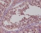 [KD]NAK/TBK1 Rabbit mAb ABZ4634