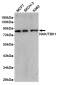 [KD]NAK/TBK1 Rabbit mAb ABZ4634