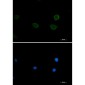 [KO]P70 S6 Kinase beta/SRK Rabbit mAb ABZ4635