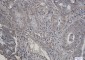 [KO]P70 S6 Kinase beta/SRK Rabbit mAb ABZ4635