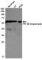 [KO]P70 S6 Kinase beta/SRK Rabbit mAb ABZ4635