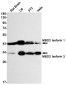 [KD]MBD2 Rabbit mAb ABZ4636