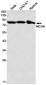 [KD]MCAK Rabbit mAb ABZ4637