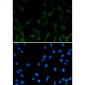 [KO]Phospho-NDRG1 (Ser330) Rabbit mAb ABZ4642