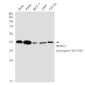 [KO]Phospho-NDRG1 (Ser330) Rabbit mAb ABZ4642
