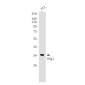 [KD]Olig1 Rabbit mAb ABZ4644