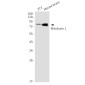 [KD]Mitofusin 1 Rabbit mAb ABZ4645
