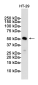 [KD]MLKL Rabbit mAb ABZ4646
