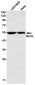 [KD]MLKL Rabbit mAb ABZ4646