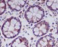 [KD]MLKL Rabbit mAb ABZ4647