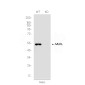 [KD]MLKL Rabbit mAb ABZ4647
