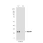 [KD]IGFBP7 Rabbit mAb ABZ4648