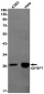 [KD]IGFBP7 Rabbit mAb ABZ4648