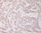 [KO]Beclin 1 Rabbit mAb ABZ4652