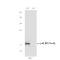 [KO]Phospho-4E BP1 (Thr46) Rabbit mAb ABZ4653