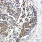 [KO]4E BP1 Rabbit mAb ABZ4654