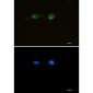 [KO]LRP1 Rabbit mAb ABZ4658