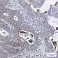 [KO]Bcl-XL Rabbit mAb ABZ4659