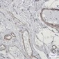 [KO]Caldesmon/CDM Rabbit mAb ABZ4661