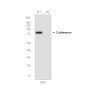 [KO]Caldesmon/CDM Rabbit mAb ABZ4661