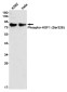 [KO]Phospho-HSF1 (Ser326) Rabbit mAb ABZ4663