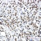 [KO]HSF1 Rabbit mAb ABZ4664