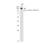 [KO]Eph receptor B4/HTK Rabbit mAb ABZ4671
