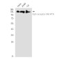 [KO]Eph receptor B4/HTK Rabbit mAb ABZ4671