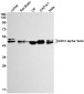 [KD]GSK3 alpha/beta Rabbit mAb ABZ4672