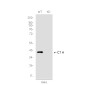 [KD]CT A Rabbit mAb ABZ4676