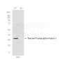[KO]Thyroid Transcription Factor 1 Rabbit mAb ABZ4678