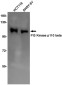 [KO]PI3 Kinase p110 beta Rabbit mAb ABZ4680