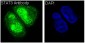 [KO]STAT3 Rabbit mAb ABZ4681