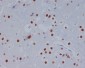 [KO]STAT3 Rabbit mAb ABZ4681