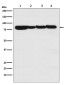 [KO]STAT3 Rabbit mAb ABZ4681