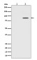 [KO]Phospho-STAT3 (Tyr705) Rabbit mAb ABZ4682