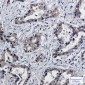 [KO]PSMB10/MECL1 Rabbit mAb ABZ4683