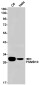 [KO]PSMB10/MECL1 Rabbit mAb ABZ4683