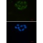 [KD]CD147 Rabbit mAb ABZ4685