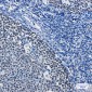 [KD]MCM5 Rabbit mAb ABZ4687